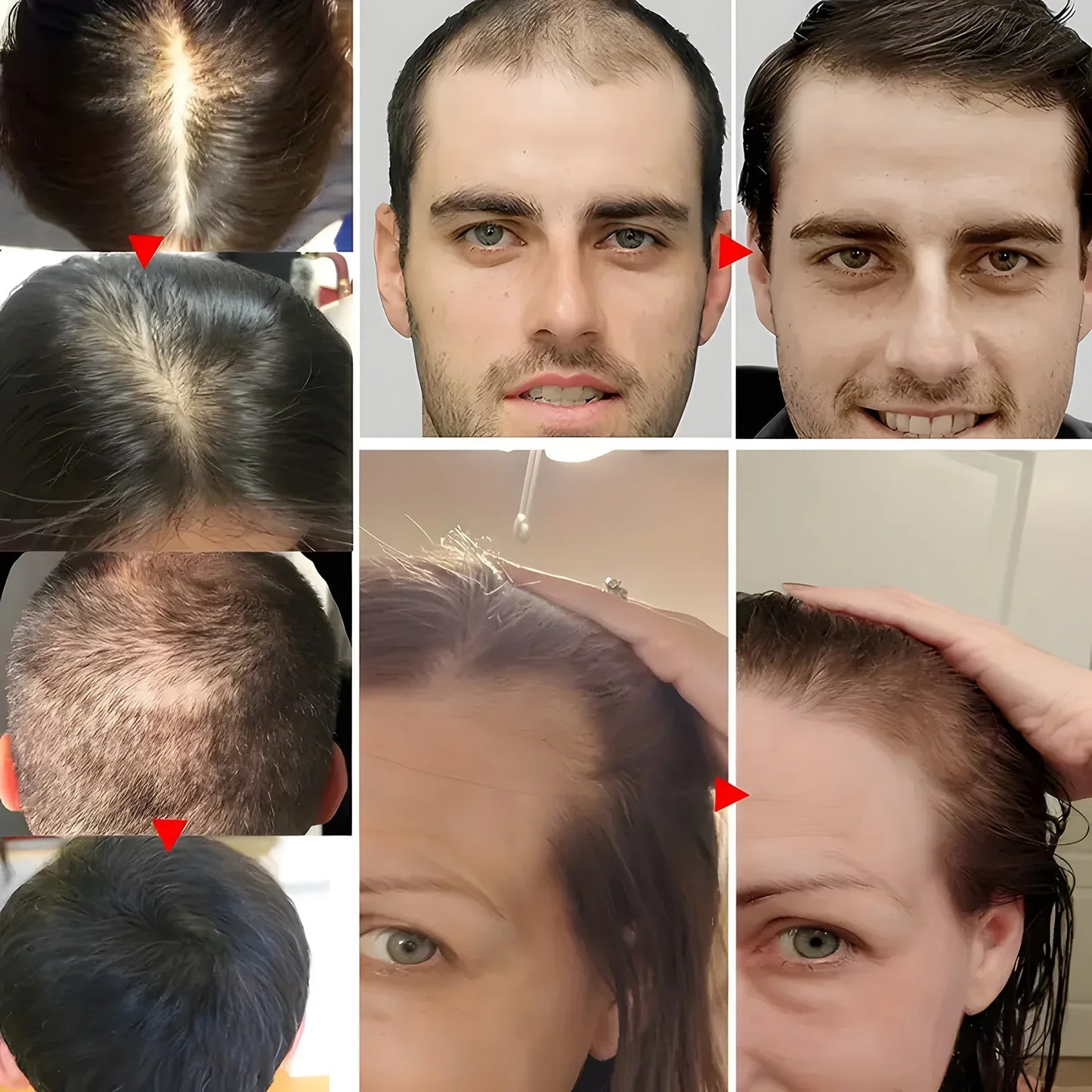 Biotin Keratin Hair Conditioner for Dry Frizz-4